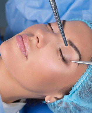 Blefaroplastia.jpg