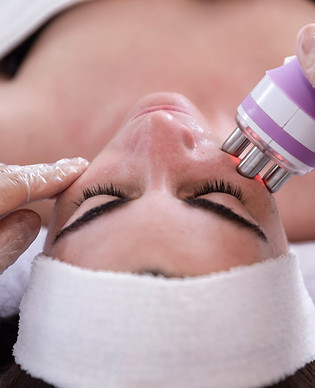Radiofrecuencia Facial.jpg