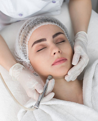 Microdermoabrasión Facial.jpg