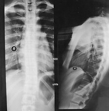 end of 14 months.jpg