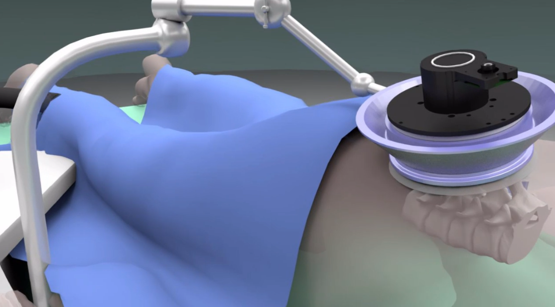 Focused ultrasound delivery