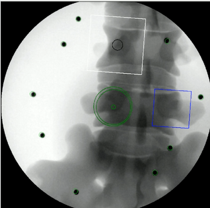 X-ray guidance