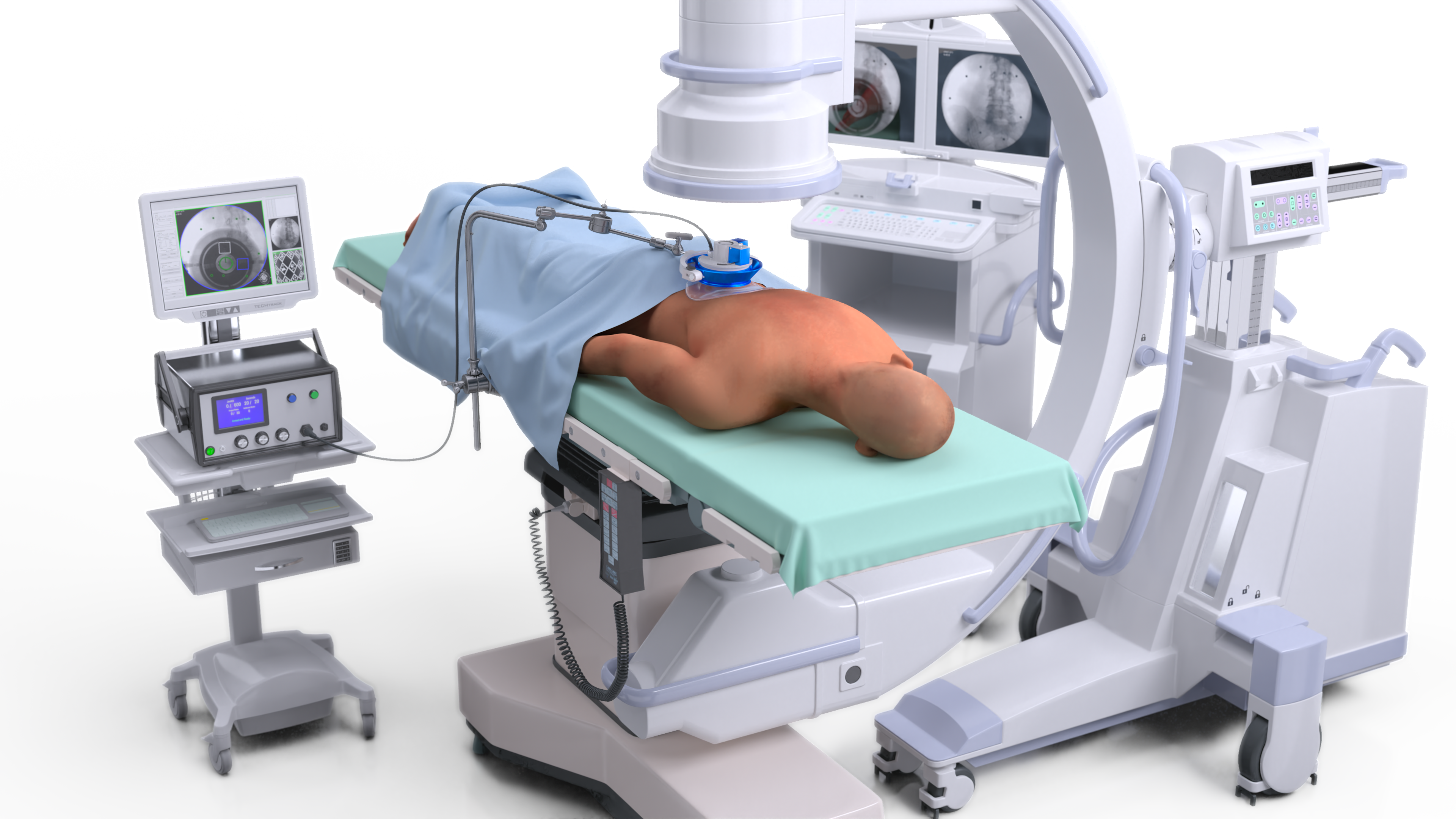The FUSMobile Neurolyser XR device