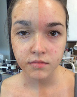 vielle (transformation) old