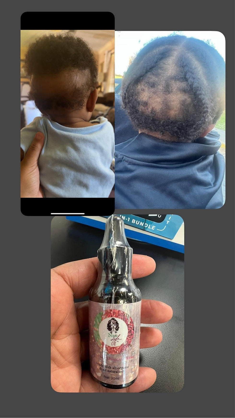 Thumbnail: New Life Hair Oil