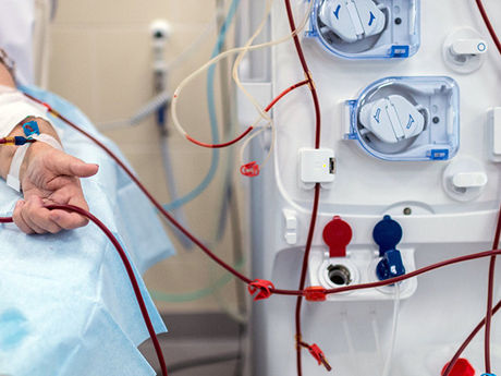 IT'S DIALYSIS DAY LOL