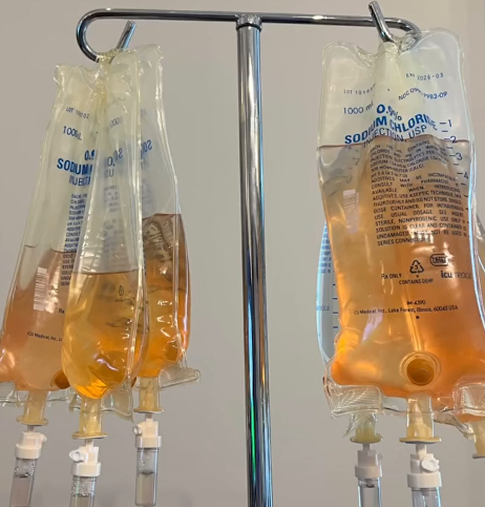 IV bags containing IV fluids suspended on a metal