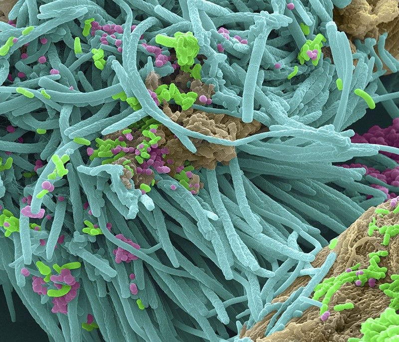colorized electron microscopy of bacteria
