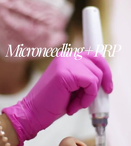 Copy of MicroneedlingREELS.png