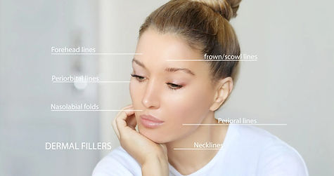 Diagram-for-dermal-fillers-2048x1138_edited.jpg