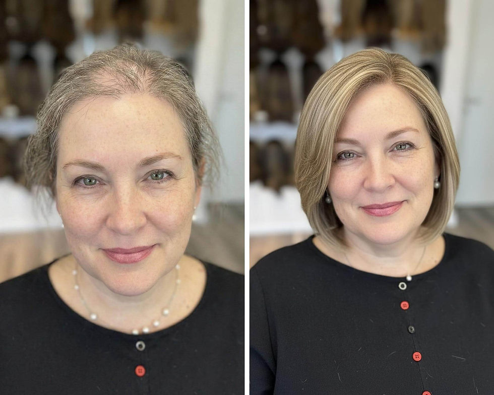 תונה של יחדית כיפה לפדחת