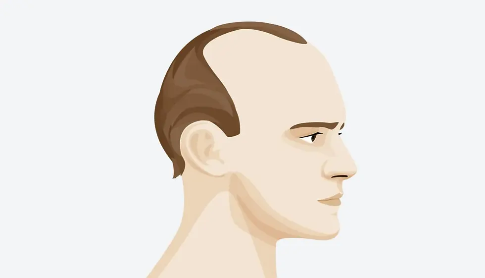 Hair system application step one