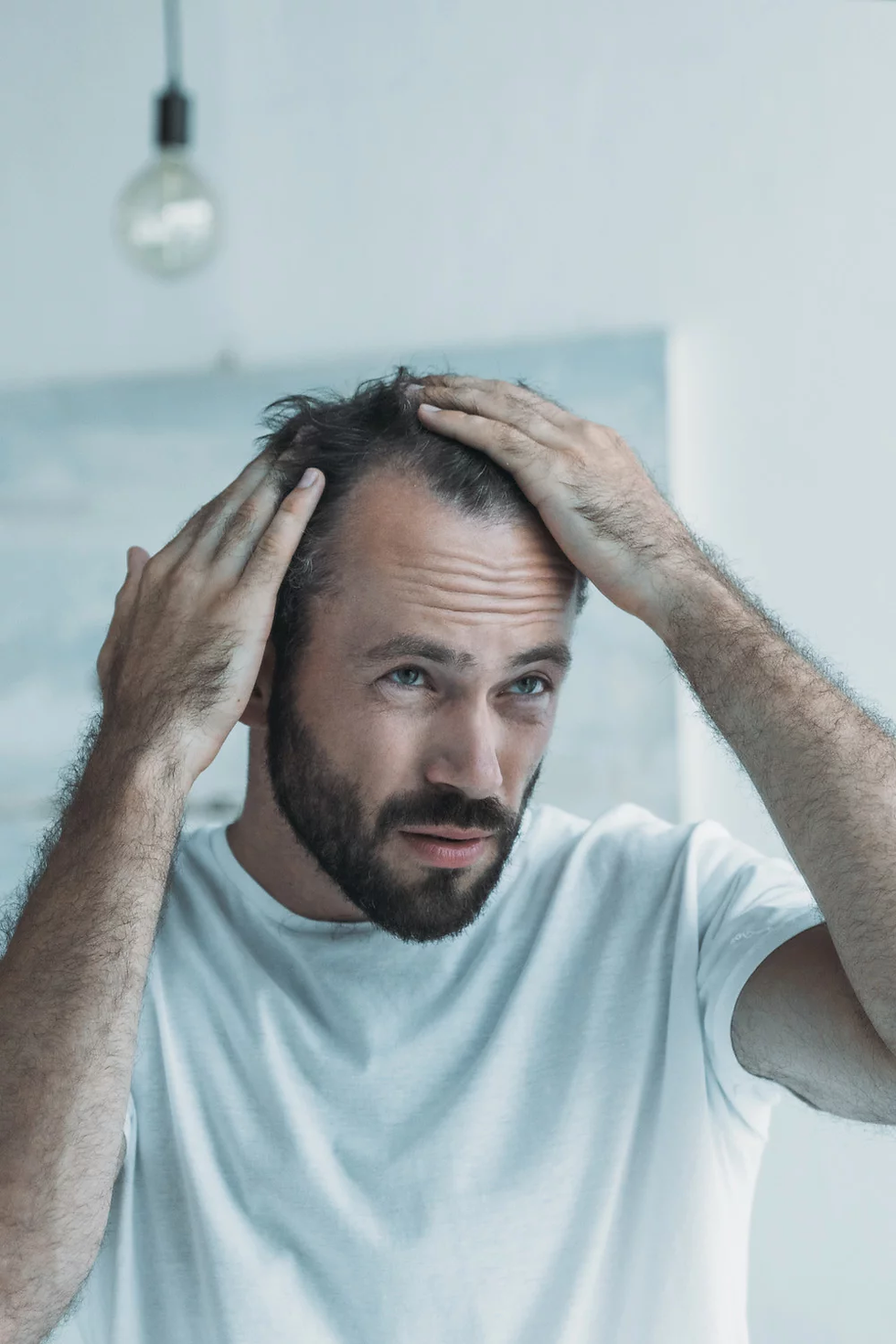 haaruitval-stadia-en-de-rol-van-hairdoctors-4.png