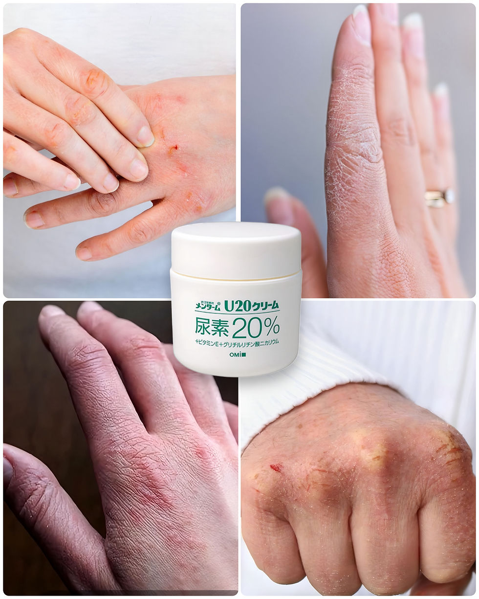 Прев'ю: OMI Крем екстразм'якшувальний для проблемних зон  U20 CREAM 90г.