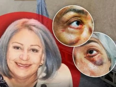 Arquitectos, abogados, enfermeras y amas de casa realizan cirugías plásticas en Chihuahua