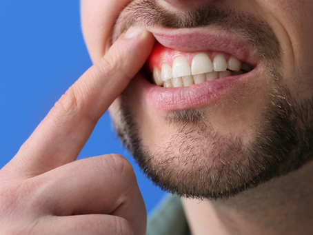 Guarding Your Smile: The Battle Against Gum Disease
