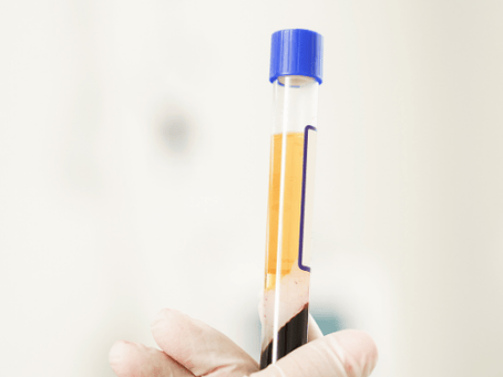 Platelet Rich Treatment: A Natural Approach to Skin Rejuvenation