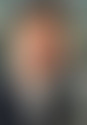 Il vero trattamento delle emorroidi - senza fregature e senza leggende