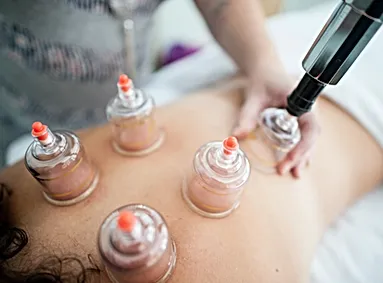 Cupping Therapy.webp