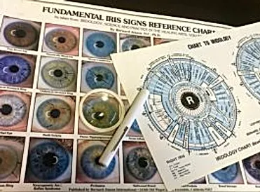 iridology.webp