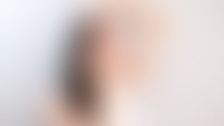 Face Yoga vorher nachher, Doppelkinn, Zornesfalten, nasolabialfalten