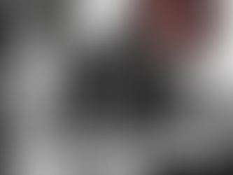 MU3R3 DON EZEQUIEL TRAS SUFRIR DERRAME CEREBRAL LUEGO DE SER VĆCTIMA DE UN ROBO