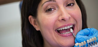 dentist-examining-female-patient-with-teeth-shades.jpg