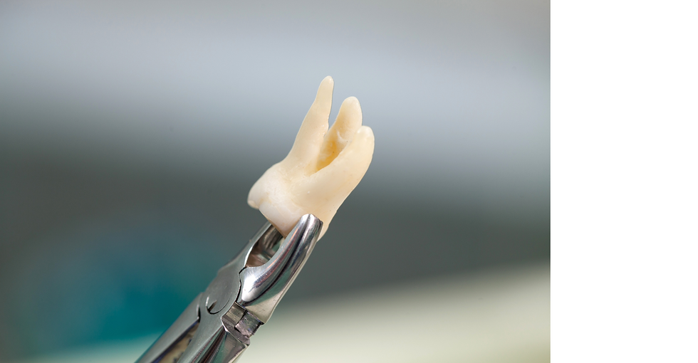 Extracted tooth with its roots