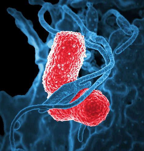 Alt text
High resolution microscopic image of red rod shaped bacteria interacting with blue cellular structures, showing microbial activity at a cellular level.