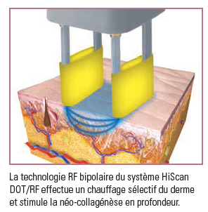 Juvilase, esthétique, laser, réjuvénation, friboug, le mouret, médecine, dermatologie, ménopause, vagin, vaginal, atrophie vaginale, syndrome genito urinaire, secheresse, brulures, irritations, infections urinaires, incontinence, démangeaisons, prurit, douleurs pendant les rapports, dyspareunie, sécheresse vaginale, mona lisa, smartxide