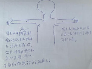《案例分析-手在麻是為什麼呢?》