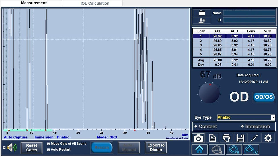 Thumbnail: A-Scan Plus Connect-Ultrasound