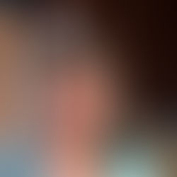 Beyond the Scale: The Silent Epidemic Affecting Bariatric Patients