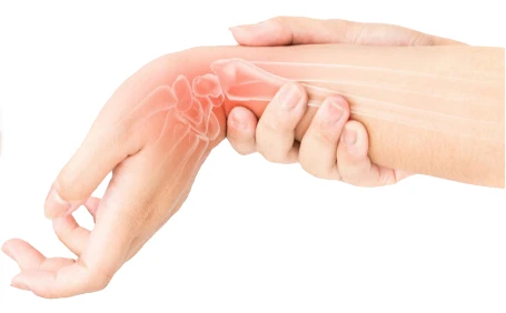 Carpel Tunnel Syndrome CPE - CPD Professional Development Study Module