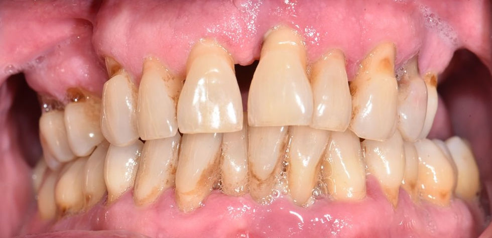 Photographie intra-buccale initiale