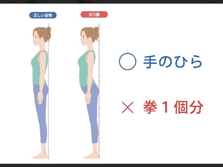 反り腰さんは、お腹側をチェック!