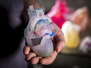 3D printing technology at Duke University helping Doctors.