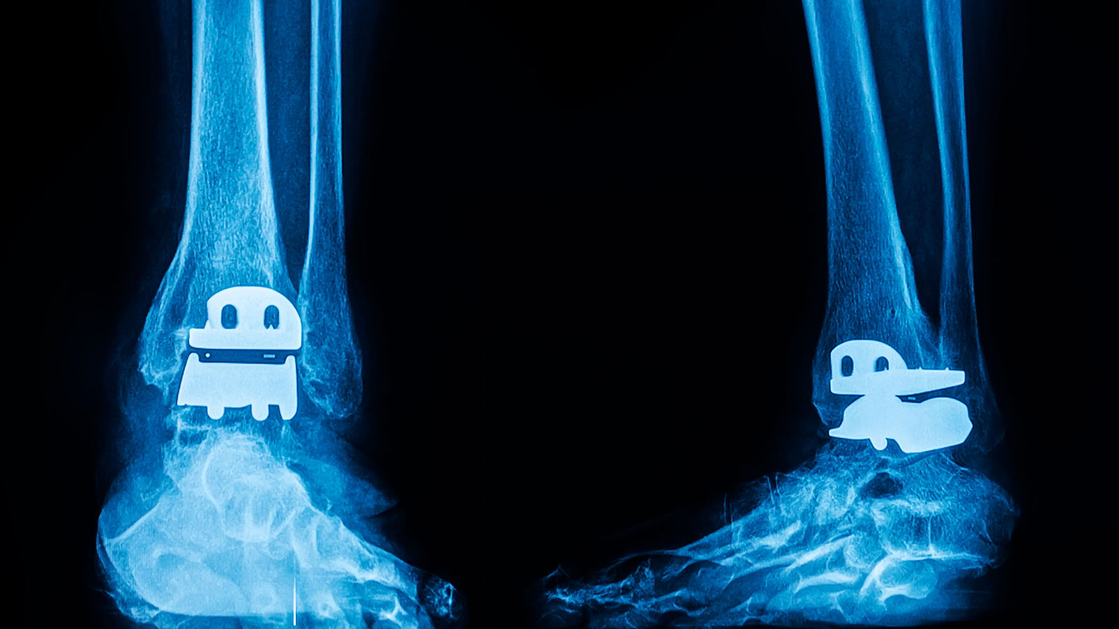 ankle-mri-1920x1080.jpg