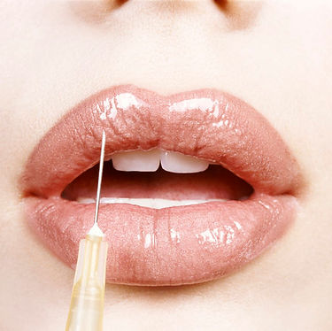Well defined plump lips with lipstick receiving filler treatment