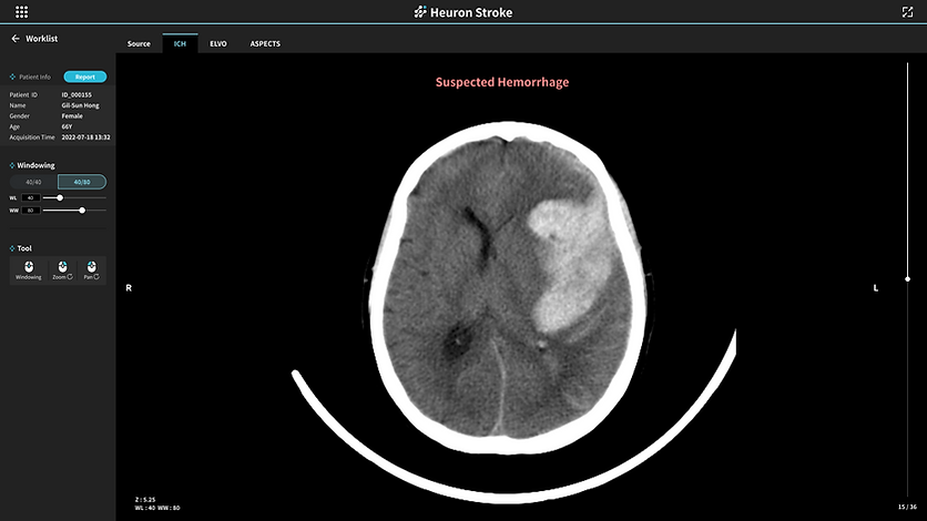 No. 21 (Heuron ICH).png