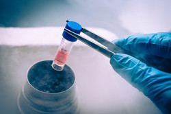 BAYLX,INC. Announced Clearance of COVID-19 IND From US FDA For Cord Mesenchymal Stem Cells