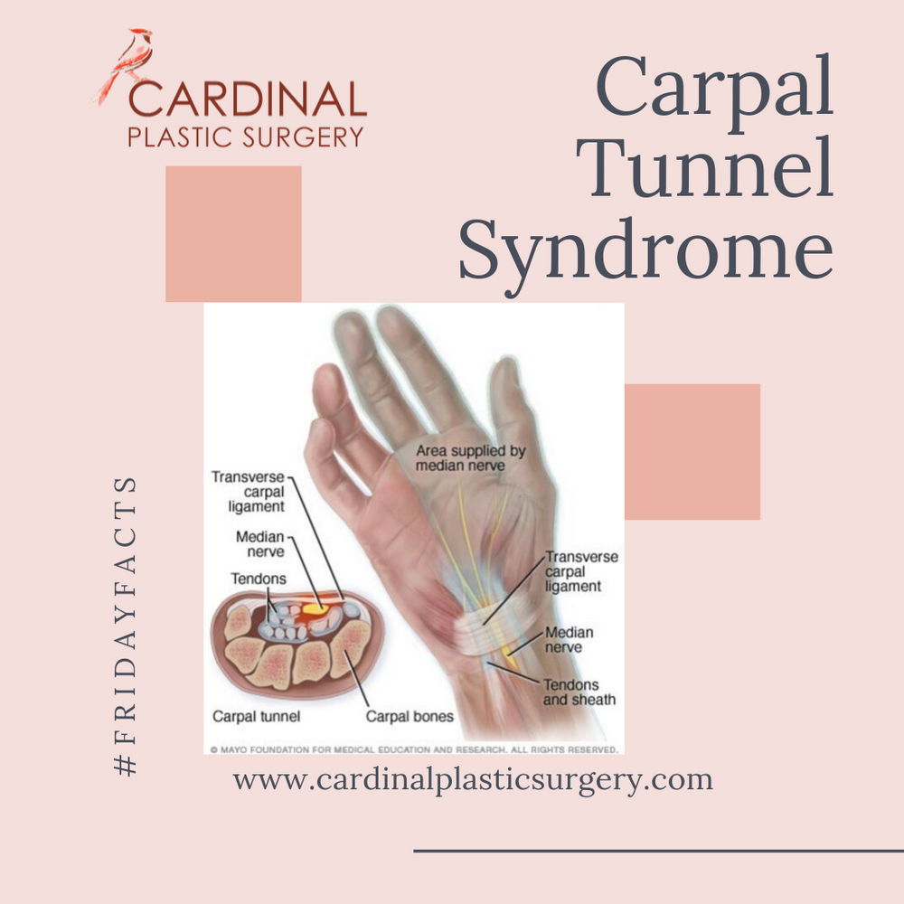 how to tell if you have carpal tunnel syndrome how to tell if you have carpal tunnel syndrome