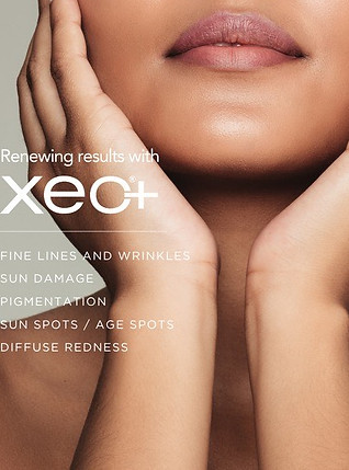 Cutera Xeo+ Laser to promote laser treatment services at Elizabeth Grace Aesthetics, a York, PA based medical spa specializing in aesthetic treatments like botox, filler, & microneeding.