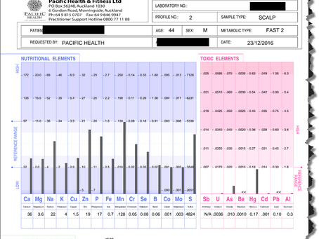 An unusual case of arthritis associated with exposure to manganese