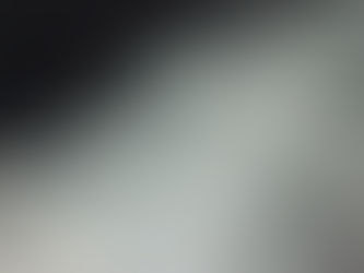 What is the best treatment for a broken (fractured) and/or dislocated collarbone (clavicle)?