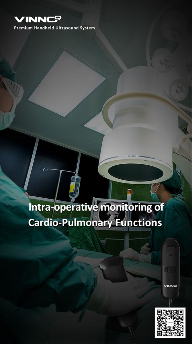 Find the best ultrasound machine for your healthcare facility in the Philippines with Care 4 Life.