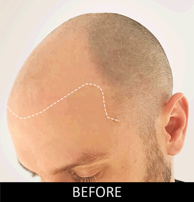 BEFORE-AFTER-SLIDE-ANIM-v3.gif