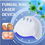 Thumbnail: Fungal Nail Laser Treatment Device for Toenail Fungus Repair and Onychomycosis