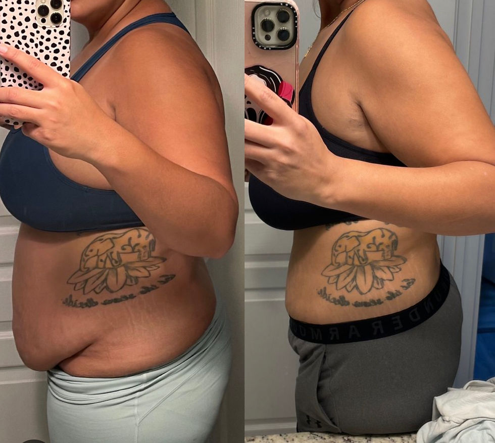 Thumbnail: 25 Bodied By O Weight Loss Patches 