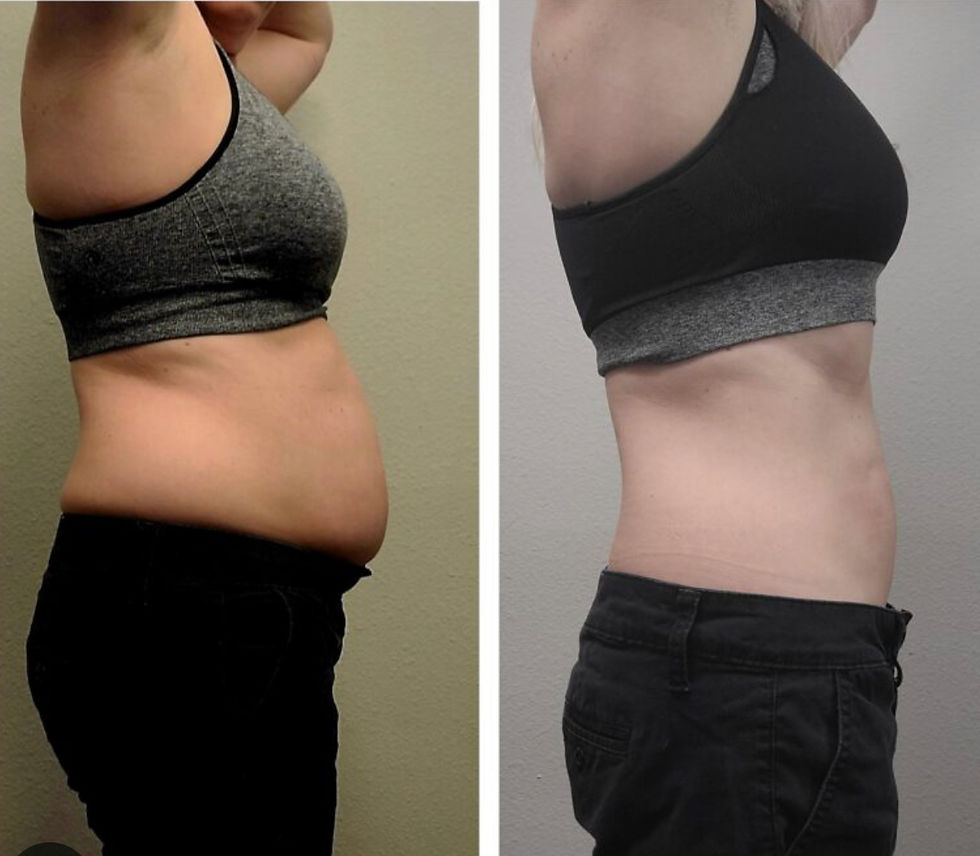 Thumbnail: 25 Bodied By O Weight Loss Patches 